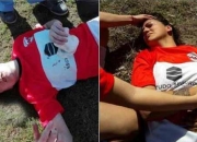 包含阿根廷女足队员受伤，将缺席下一场比赛的词条